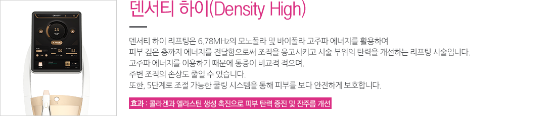 덴서티 하이
