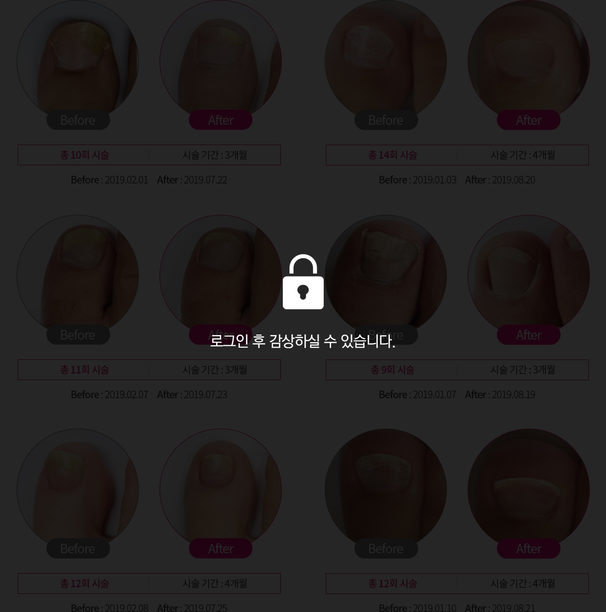 로그인전