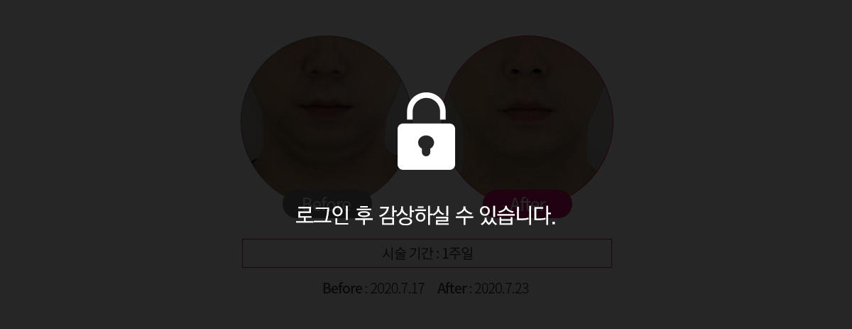 로그인전