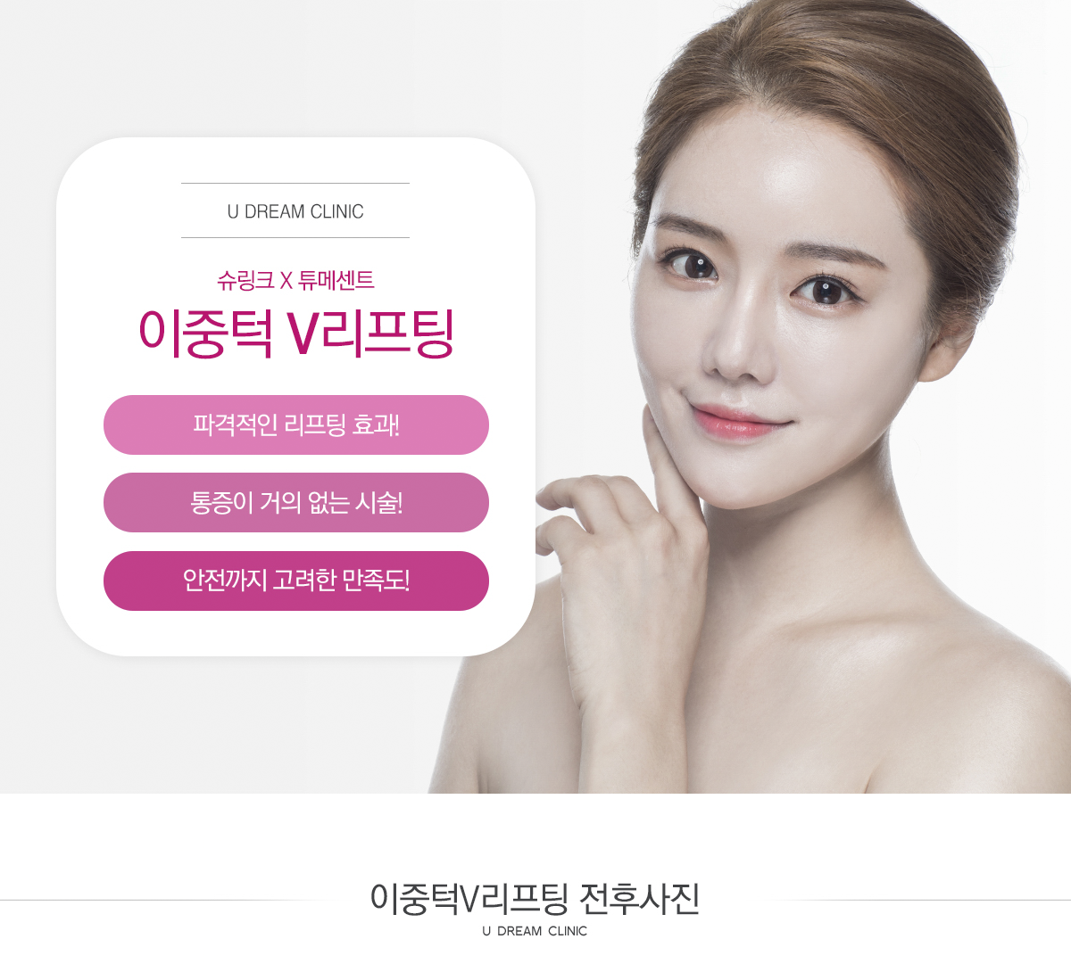 이중턱V리프팅
